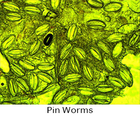Pin Worms